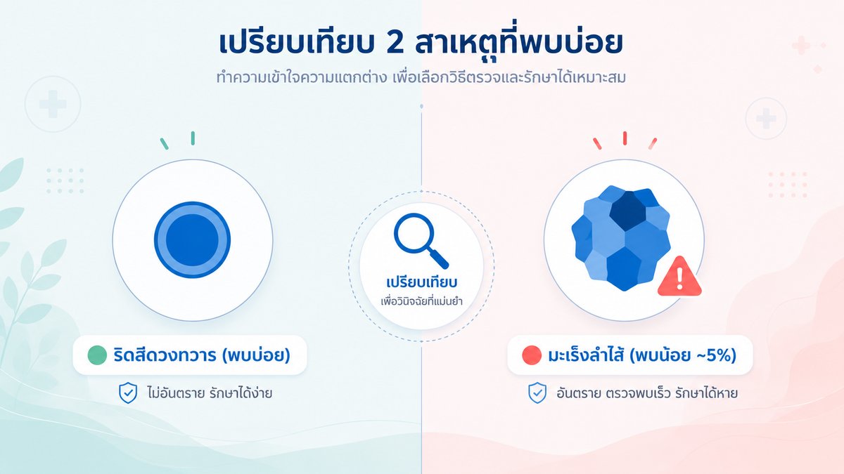 เปรียบเทียบ ริดสีดวง vs มะเร็งลำไส้